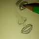 in Eye