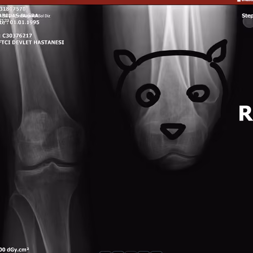 DoggedKnee - XRay