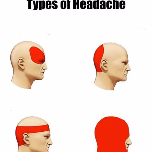 headache 4 steps