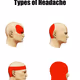 headache 4 steps