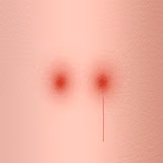 Zora Posts
